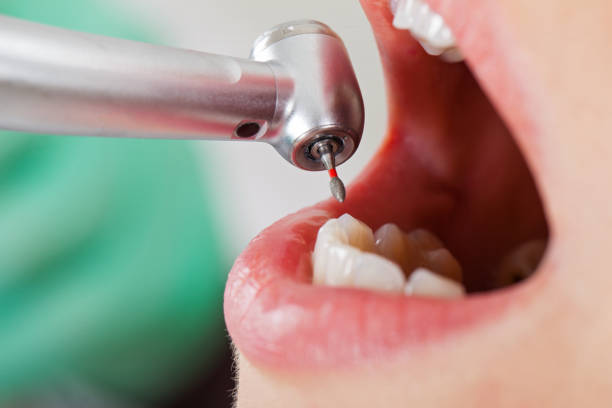 Best Same-Day Emergency Dentist in La Huerta, NM